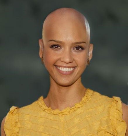 baldness3-26-10-2013.jpg